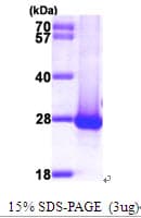 Human GBTS1 / DIRAS1 Protein (Recombinant His)