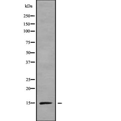 RPS15A Antibody