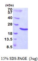 Human HSPB6 / HSP20 Protein (Recombinant His)