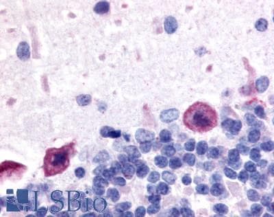 IHC-plus™ Polyclonal Rabbit anti-Human ADORA1 / Adenosine A1 Receptor Antibody (C-Terminus, IHC)