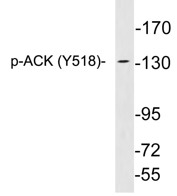 Polyclonal Rabbit anti-Human TNK2 / ACK1 Antibody (phospho-Tyr518, WB)