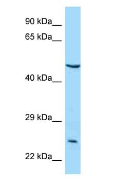 Polyclonal Rabbit anti-Human IL5RA / CD125 Antibody (aa42-91, WB)