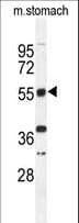 TNRC9 / TOX3 Antibody (aa214-242)
