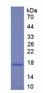 Human CALR / Calreticulin Protein (Recombinant His)