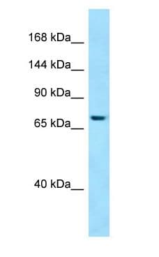 SBF1 / MTMR5 Antibody (aa698-747)