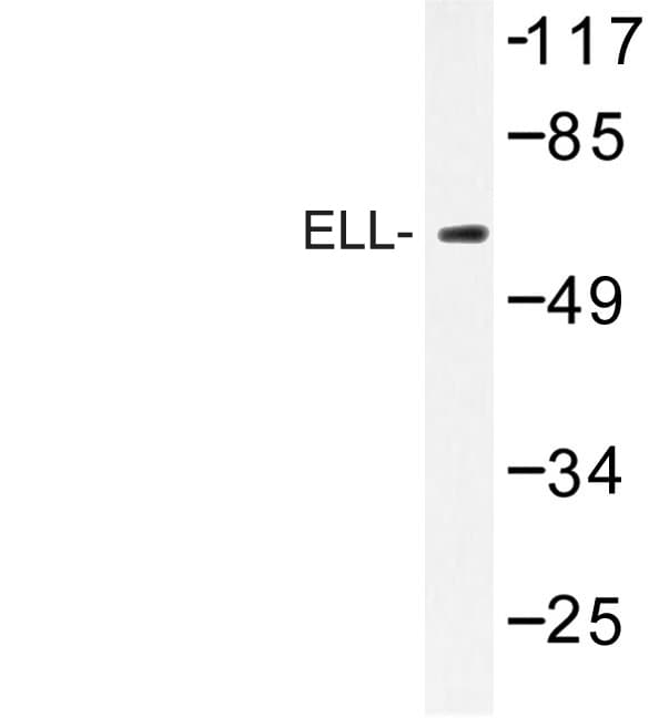 ELL / MEN Antibody (Asp125)