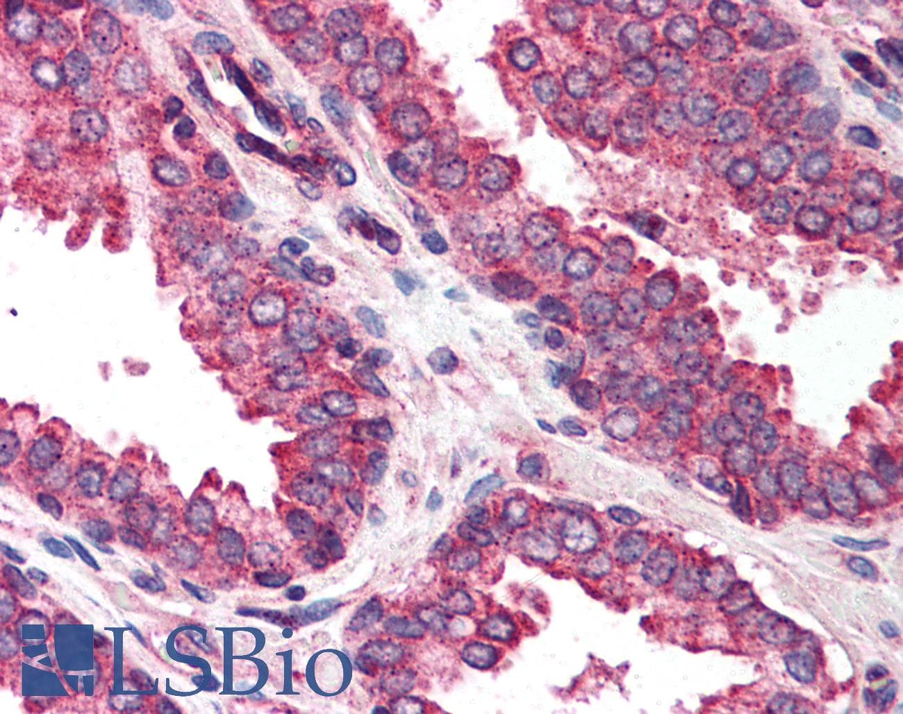IHC-plus™ DAD1 Antibody