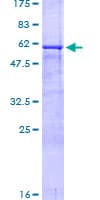 Human CD40 Protein (Recombinant GST)
