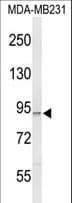 PIK3CG / PI3K Gamma Antibody