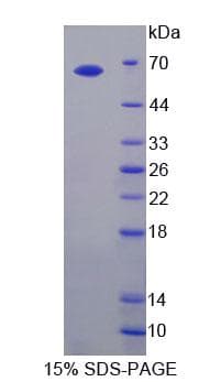 Rat TLR3 Protein (Recombinant His-GST, N-terminus)