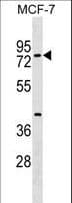 TOX4 / C14orf92 Antibody (aa172-199)