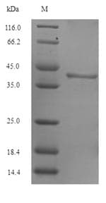 Arabidopsis thaliana SPS1 Protein (Recombinant 6His-SUMO, N-terminus)