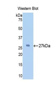 HSPG2 / Perlecan Antibody (aa4149-4391)