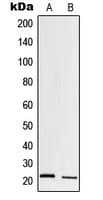 Polyclonal Rabbit anti-Human PRSS1 / Trypsin Antibody (Internal, WB)