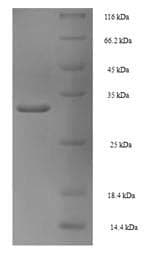 Mouse PDK4 Protein (Recombinant 6His, N-terminus)