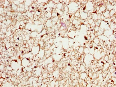 Polyclonal Rabbit anti-Human PSME3 Antibody (IHC, WB)