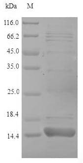 Dictyostelium discoideum ponA Protein (Recombinant 6His, N-terminus)