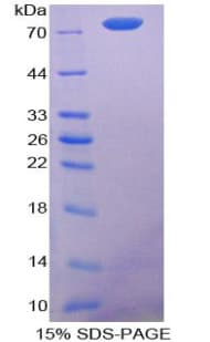 Mouse CASP12 / Caspase 12 Protein (Recombinant His-GST)