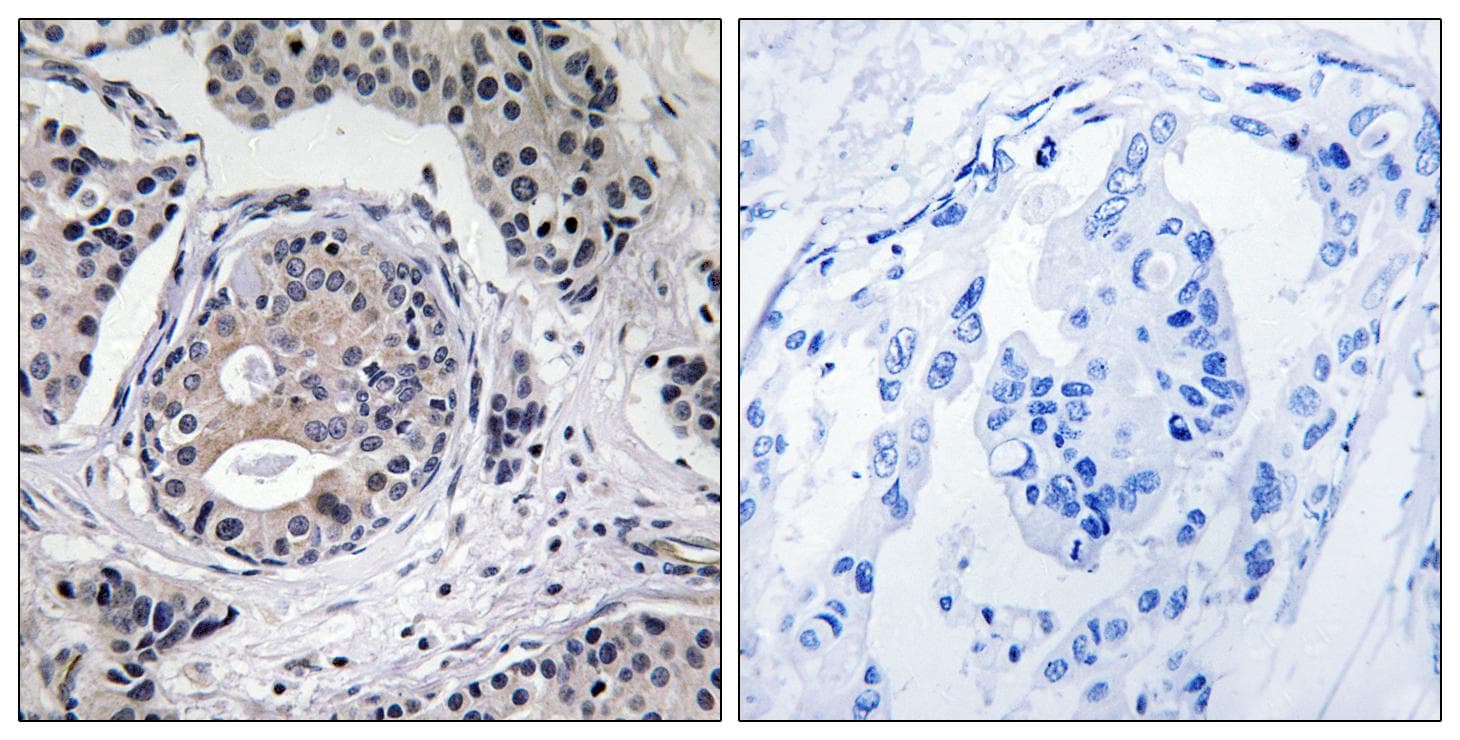 Polyclonal Rabbit anti-Human EEF2K Antibody (phospho-Ser359, IHC)