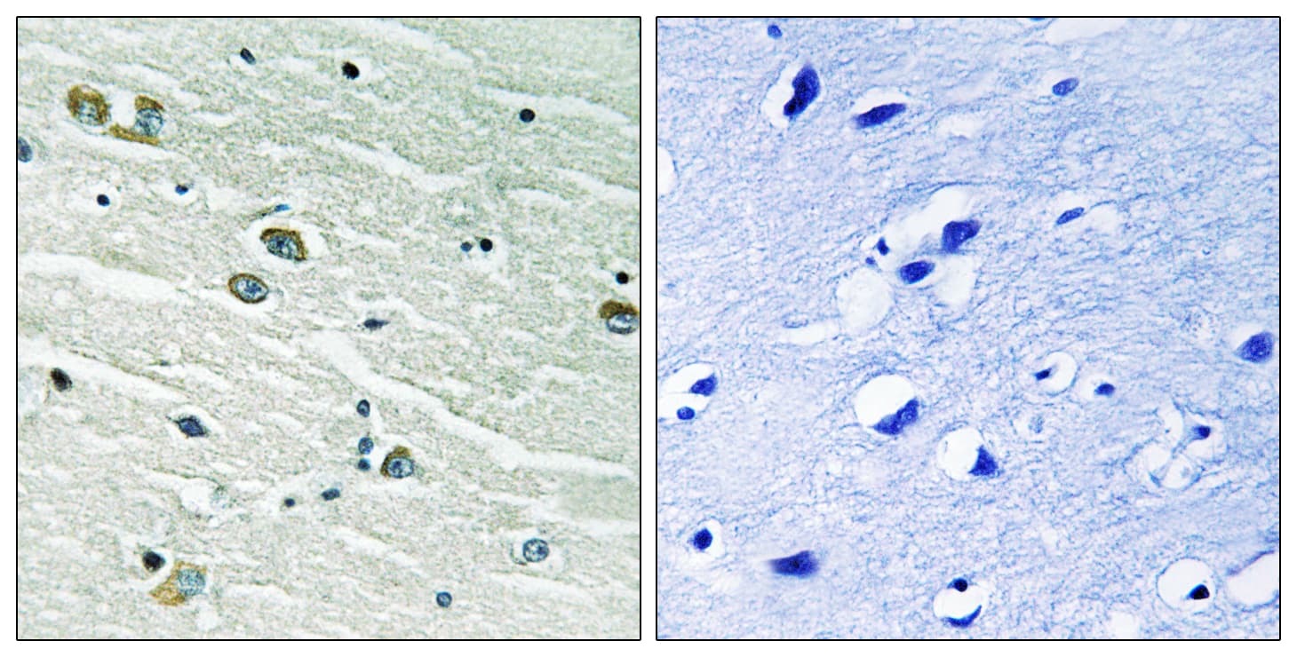 Polyclonal Rabbit anti-Human MER / MERTK Antibody (aa716-765, IHC, WB)