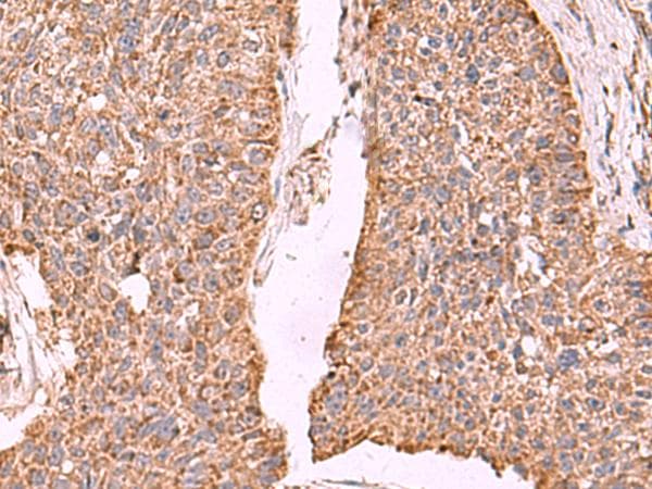 PER3 Antibody