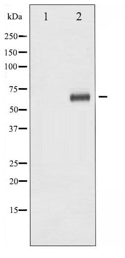 STK11 / LKB1 Antibody (phospho-Ser428)
