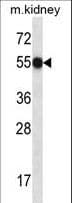 FASTK / FAST Antibody (aa14-41)
