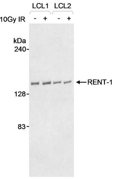 RENT1 / UPF1 Antibody (aa250-300)