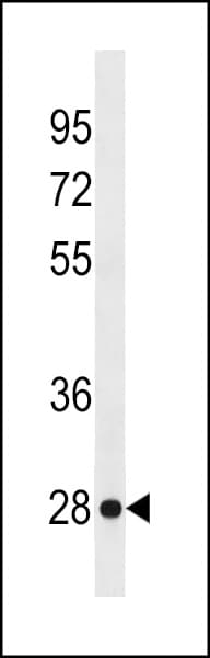 KLRF2 Antibody (aa4-30)