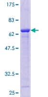 Human AKR7A2 / AFAR Protein (Recombinant GST)