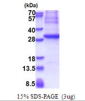 Human GAD1 / GAD67 Protein (Recombinant His)