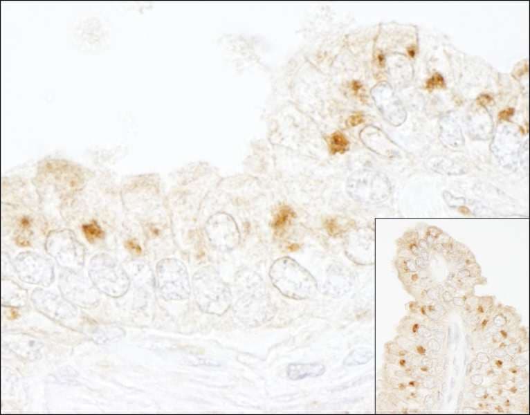 Polyclonal Rabbit anti-Human GBF1 Antibody (aa1809-1859, IHC)