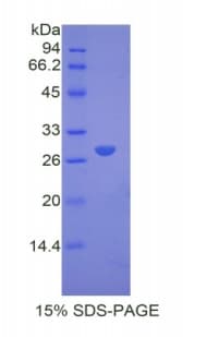 Mouse A2M / Alpha-2-Macroglobulin Protein (Recombinant His)