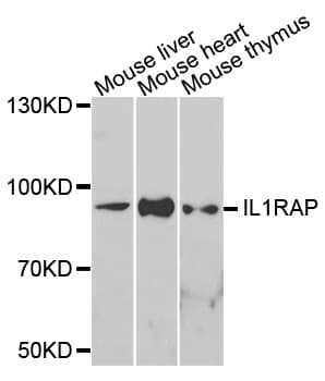 Polyclonal Rabbit anti-Human IL1RAP Antibody (AP, IHC, WB)