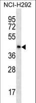 SPESP1 Antibody (aa236-262)
