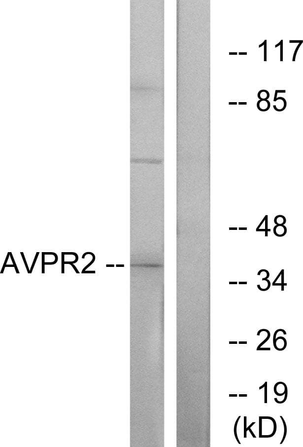 AVPR2 / V2R Antibody