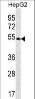 MGAT4C Antibody (aa303-332)