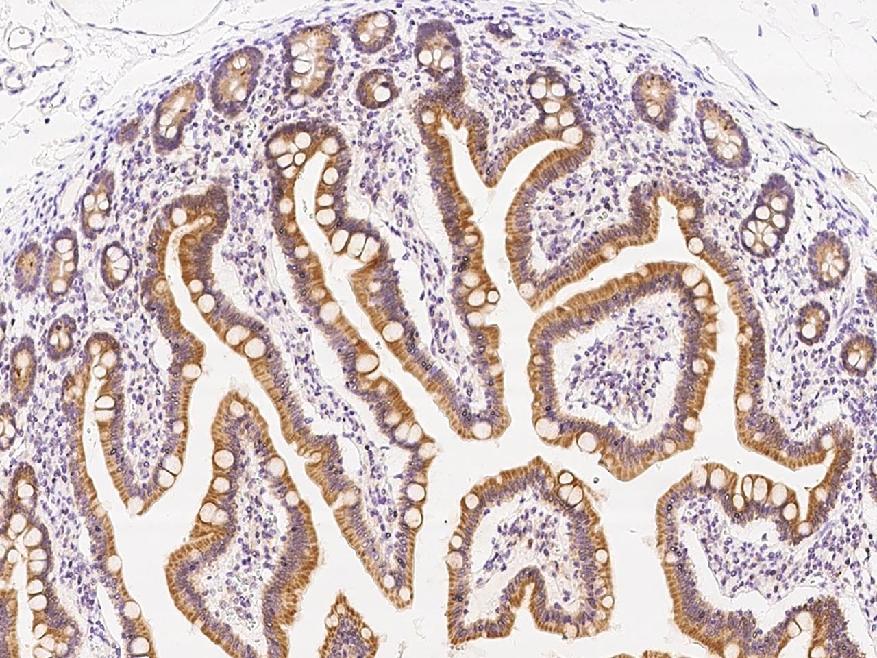 AADAC Antibody (Preservative Free)