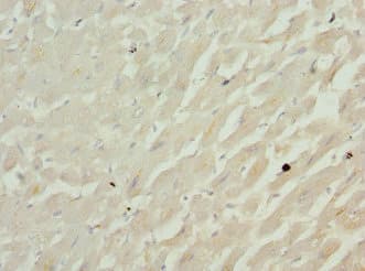 Polyclonal Rabbit anti-Human CFL2 / Cofilin 2 Antibody (IHC, WB)