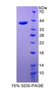 Human RELN / Reelin Protein (Recombinant His-T7)
