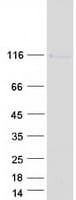 Human GRIK2 / GLUR6 Protein (Recombinant Myc-DDK (Flag))