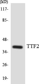 FOXE2 / FOXE1 Antibody (aa11-60)