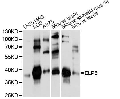 Polyclonal Rabbit anti-Human ELP5 Antibody (WB)