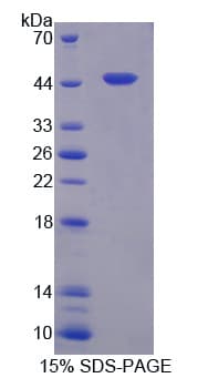 Rat DKK3 Protein (Recombinant His, N-Terminal)