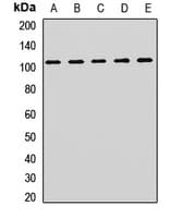 Polyclonal Rabbit anti-Human ACTN2 Antibody (WB)