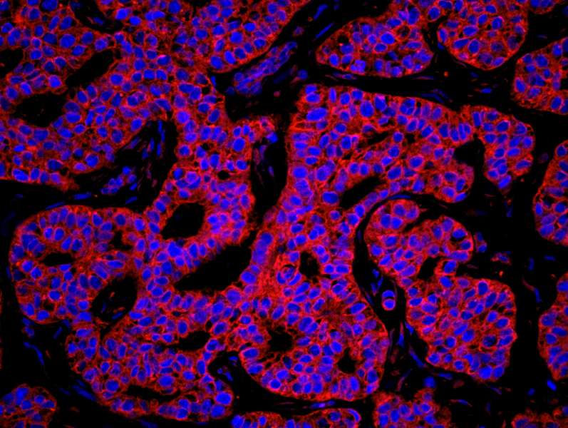 KARS Antibody (aa550-C-term)