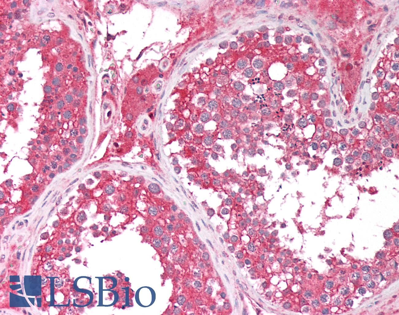 IHC-plus™ RAB5B Antibody