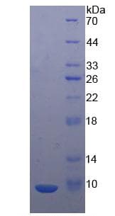 Mouse MIP2 / GRO2 / CXCL2 Protein (Recombinant His, N-Terminal)