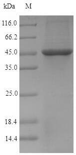 Chlamydia trachomatis pmpD Protein (Recombinant 6His-SUMO, N-terminus)