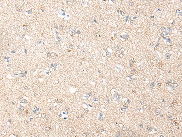 Polyclonal Rabbit anti-Human PNPO Antibody (IHC, WB)
